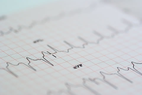 EKG Kardiologie Krefeld